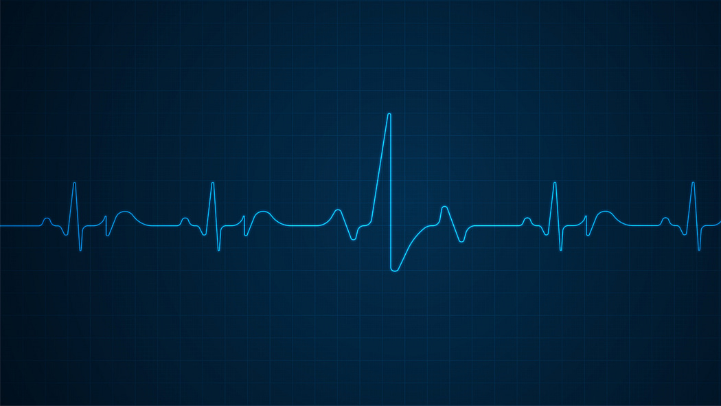 A picture of heart pulse